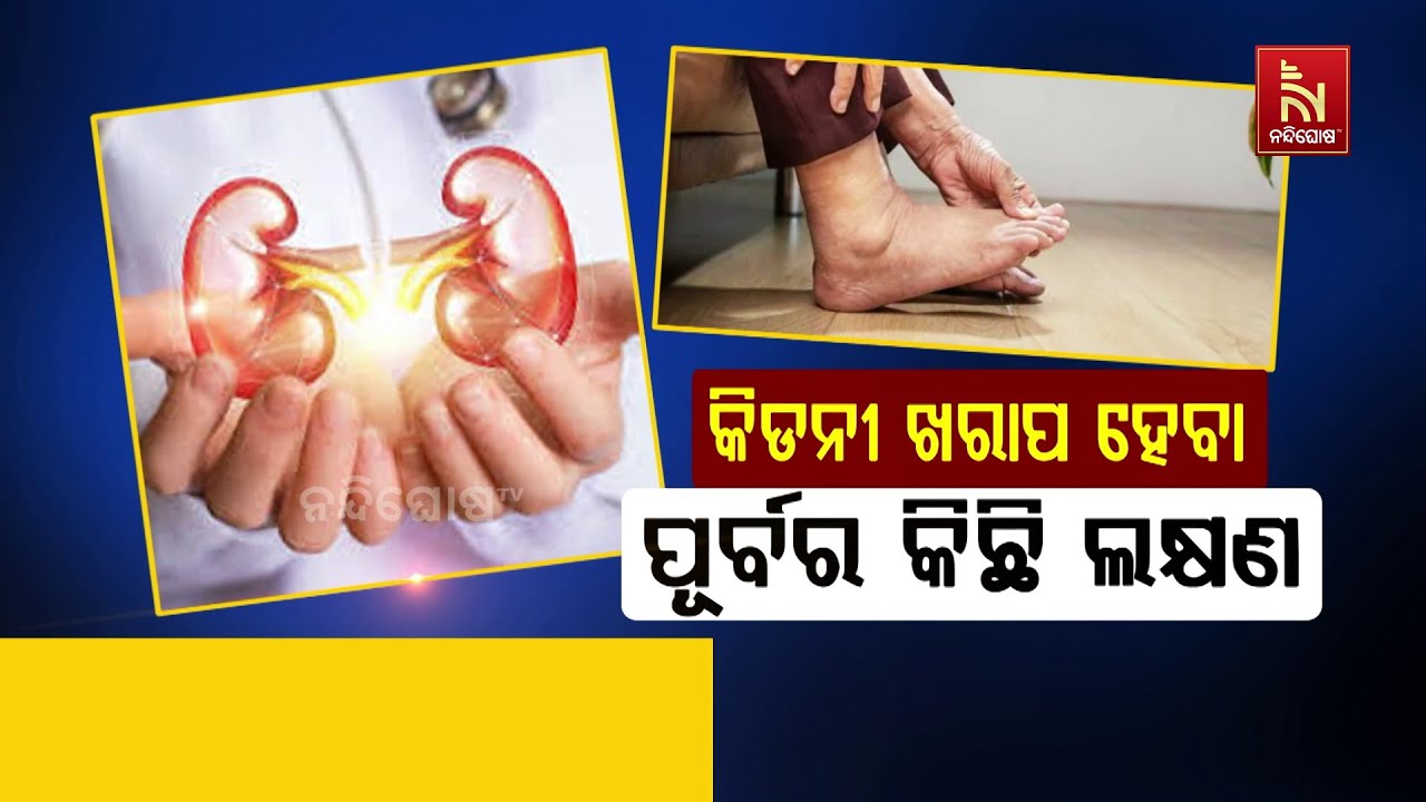 Kidney Failure Symptoms | Symptoms of Kidney Disease | How to Keep Your Kidney Healthy & Clean?