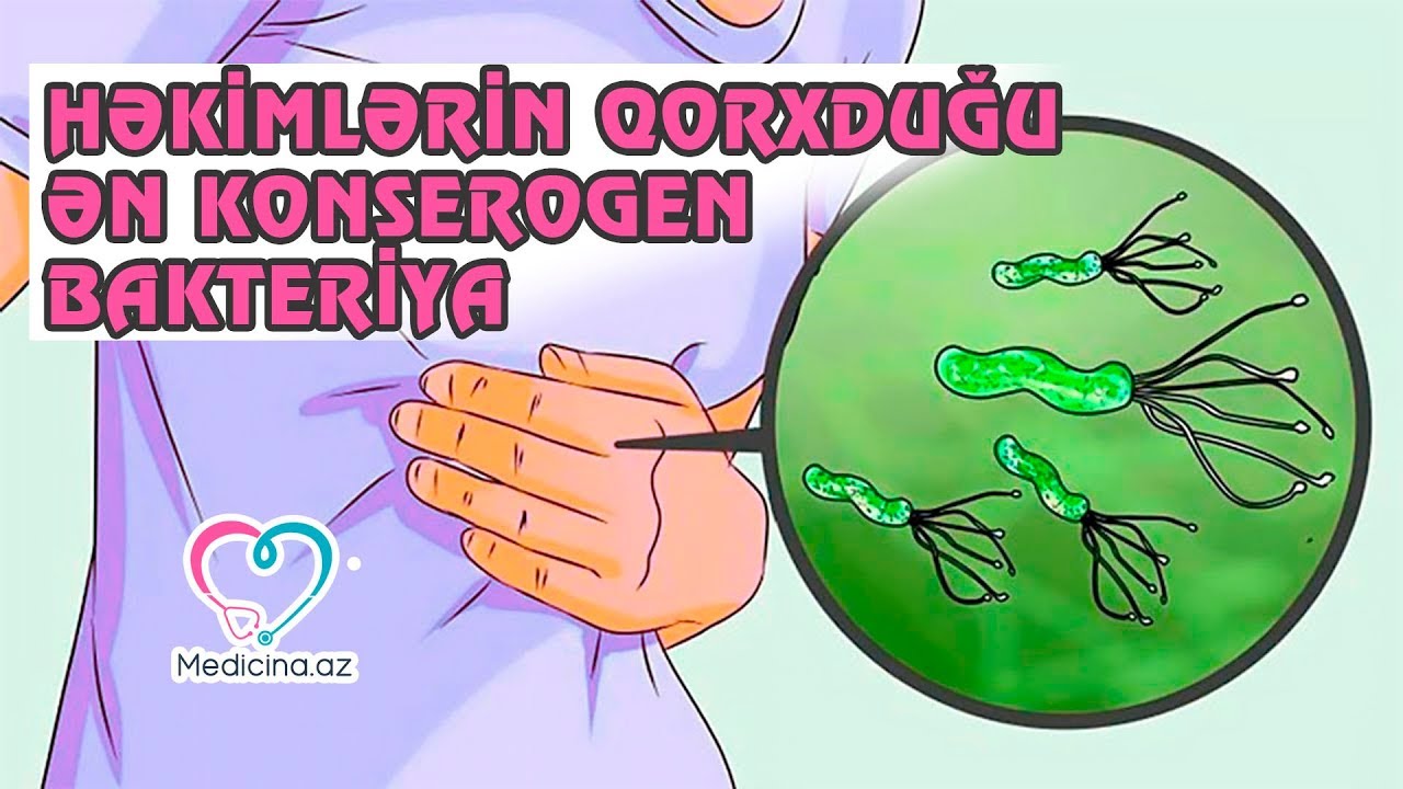 Helicobacter Pylori bakteriyası haqqında 5 fakt