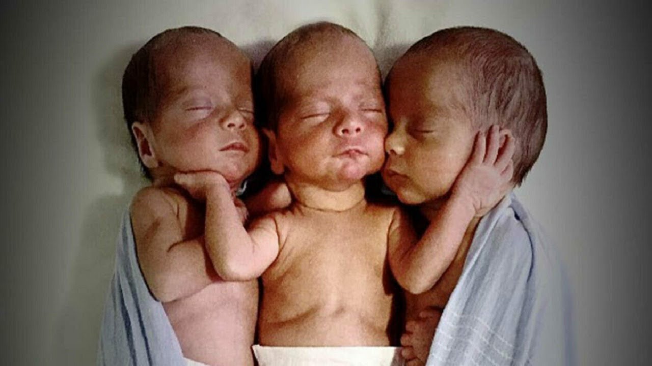 Mom Rushes To Hospital To Deliver Triplets: Then Doctors Look Closer At Their Faces And Freeze
