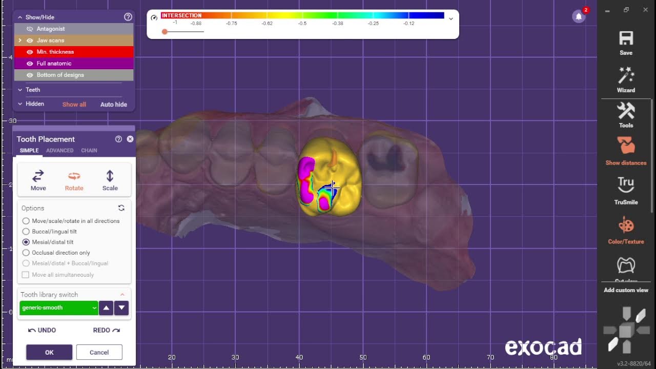 midnight exocad conception
