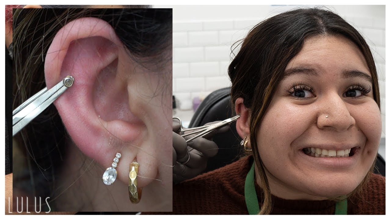 Removing An Earring That Was Stuck For 4 Years!!