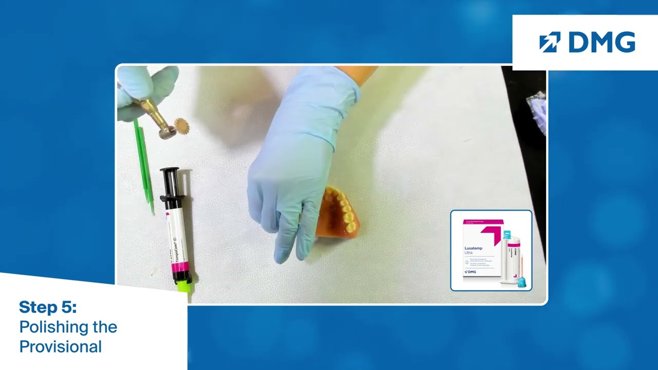 Clinical Provisional Crown and Bridge Workflow: Step 5, Polishing the Provisional