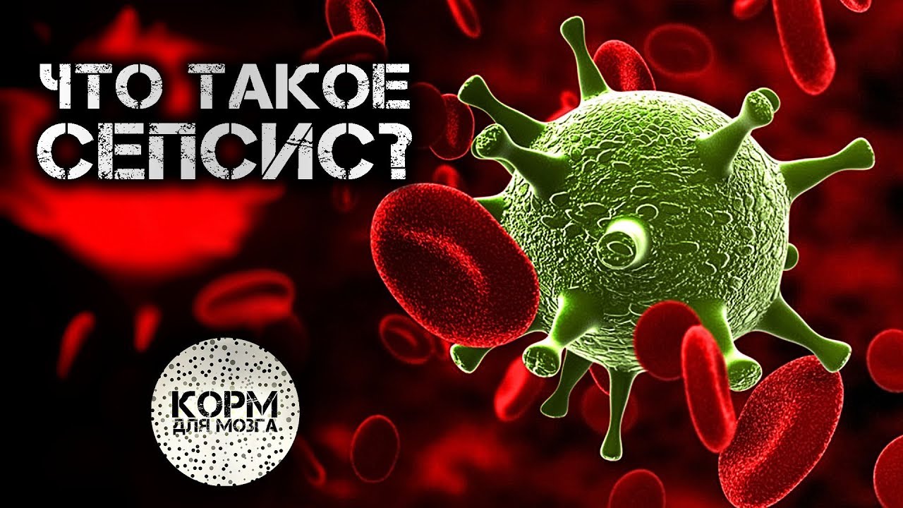 Что такое Сепсис?