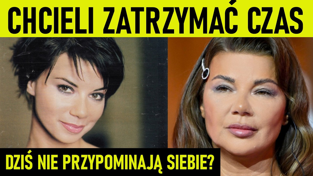 15 gwiazd, które przesadziły z medycyną estetyczną? Rozpoznasz ich twarze?