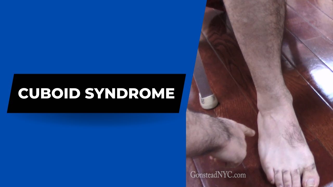 Cuboid syndrome, lockjaw, bicep tendon dislocation HELPED Dr Suh Specific Chiropractic NYC