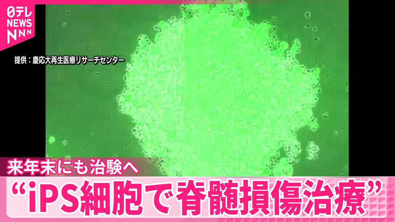 【世界初】慶応大学発ベンチャー企業 来年末にも治験へ “iPS細胞で脊髄損傷治療”
