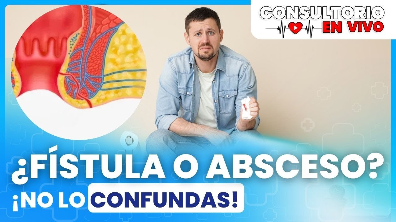 👉 ¿Qué es una fístula perianal y cómo se trata? | Cirugía 24 Horas en Vivo