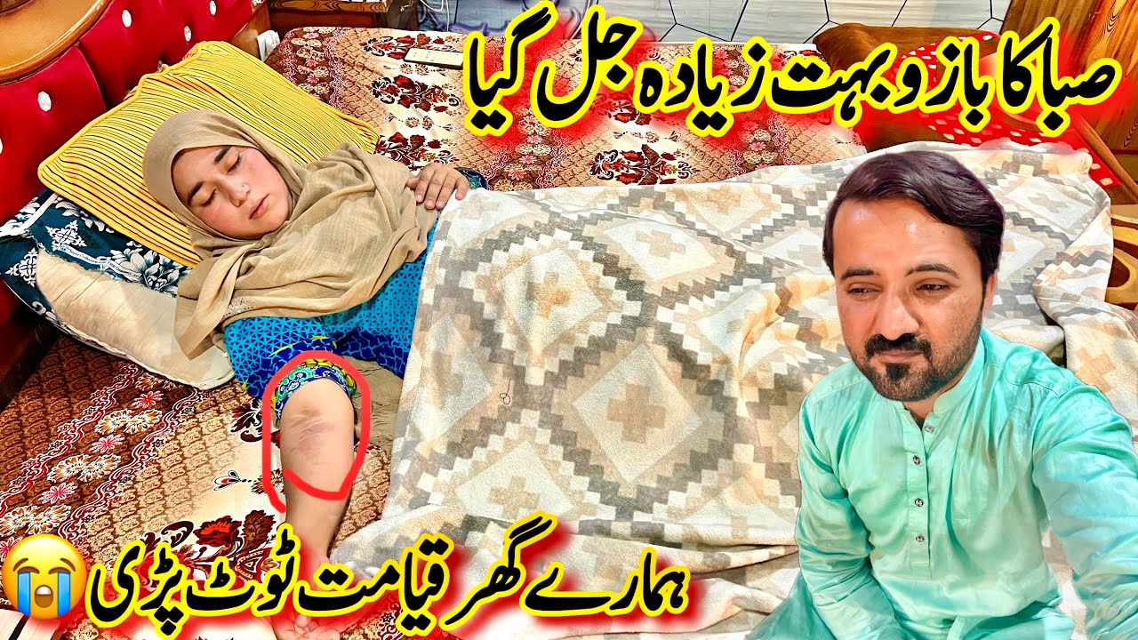 Ya Allah Khair Ye Kya Ho Gaya😭| Saba Ka Bazoo Jal Gaya😢| Saba Ahmad Vlogs