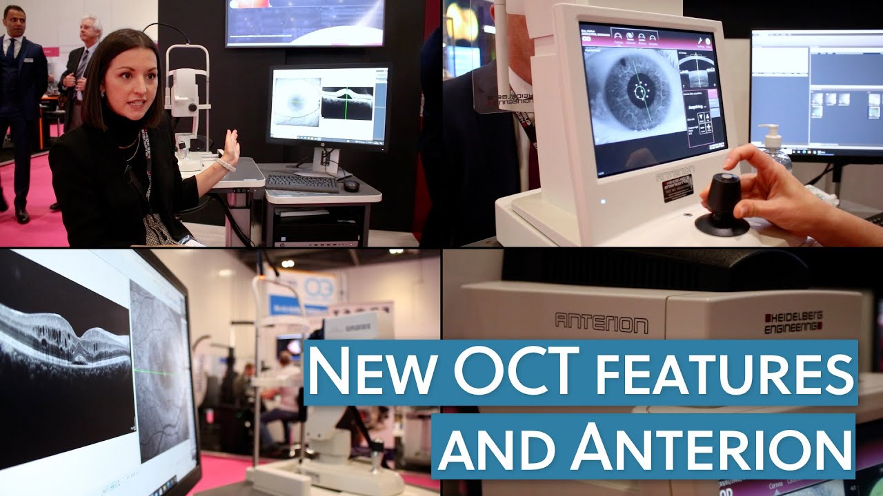 Spectralis & Anterion | Heidelberg Engineering at 100% Optical