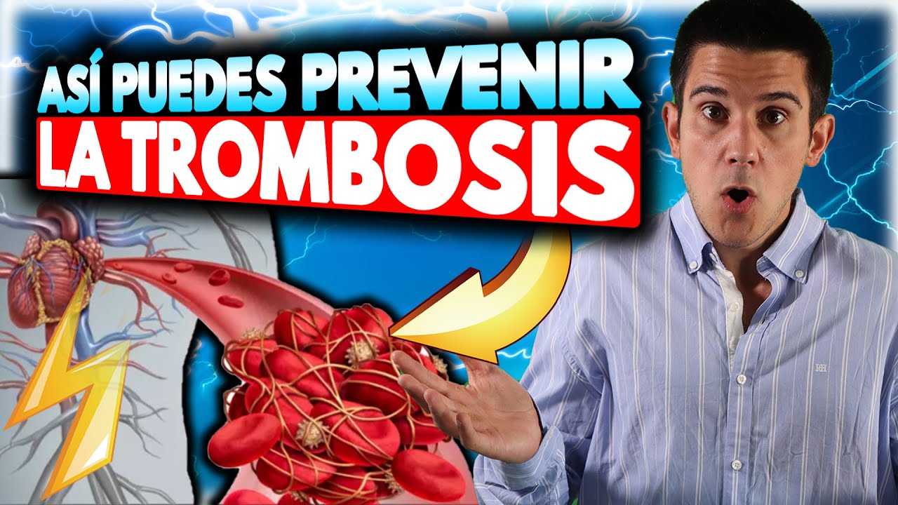 ☠️⚠️11 Alimentos que podrían ayudar a *PREVENIR* la formación de TROMBOS o COÁGULOS 🍉[No los obvies]