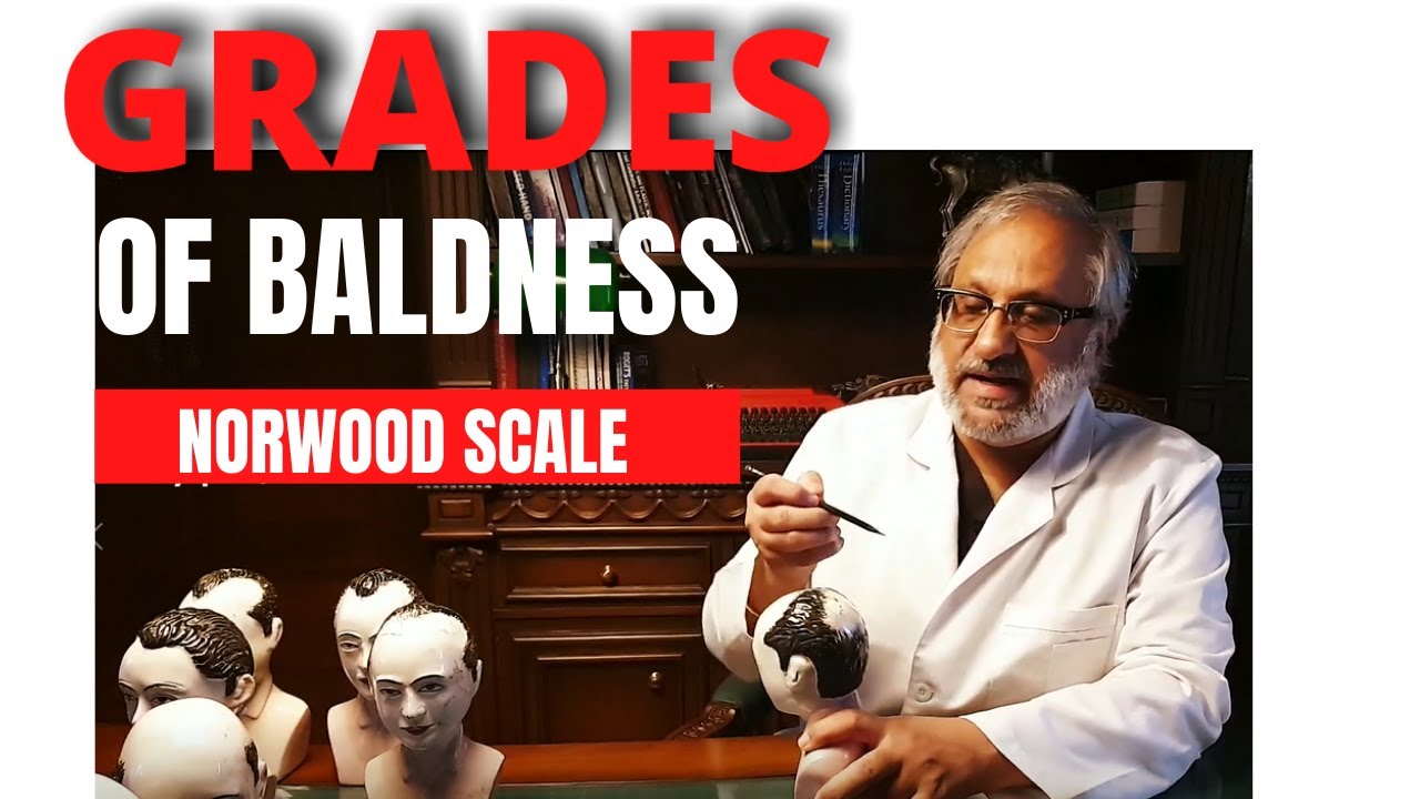 Grades and level of Baldness ( Norwood Scale )