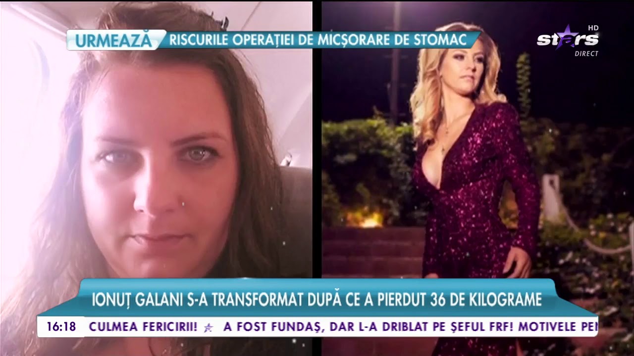 Vedete care și-au tăiat stomacul pentru a slăbi