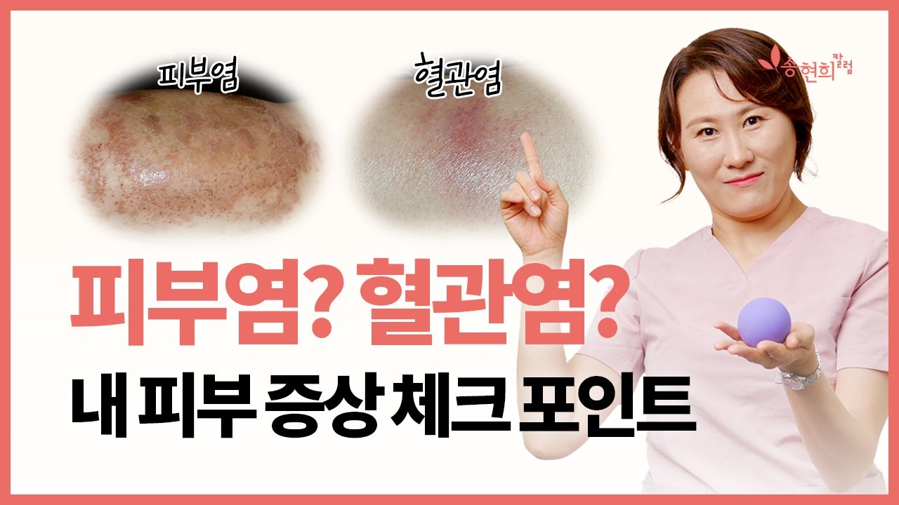 피부염 VS 혈관염 3가지로 구분! 피부혈관염에 좋은 운동법