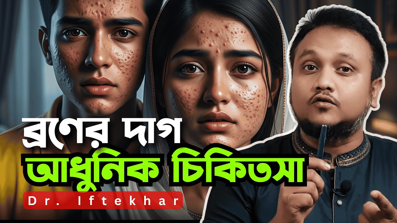 ব্রণের দাগ দূর করার ক্রিম | dark spot acne scar treatment | মুখের দাগ দূর করার উপায়