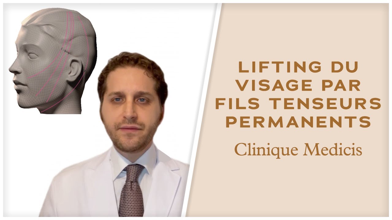 Lifting du visage par fils tenseurs permanents