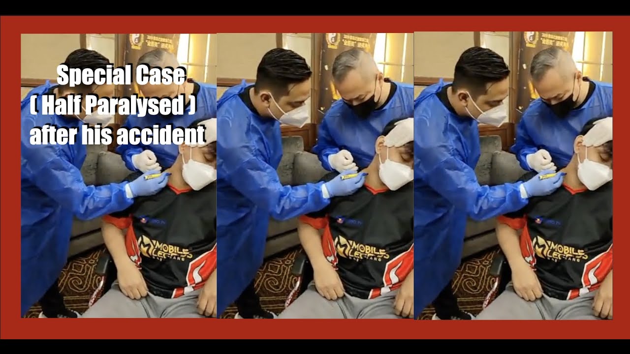 Special Case (Half Paralysed) after his accident - Chris Leong | MostAmazingTop10  | TOP 3 Most
