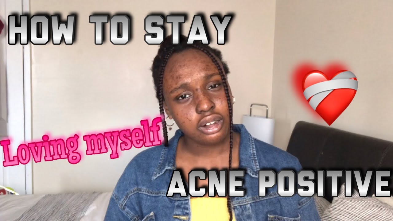 ACNE POSITIVITY | how to love your skin no matter what | what I did 🙂