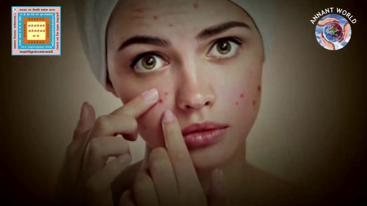 Bhaktamar Stotra 31 no shloka : For Curing Skin Diseases by Dr. Prriya Pradeep Jain
