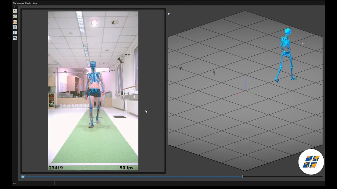 Qualisys | Markerless Motion Capture Solution