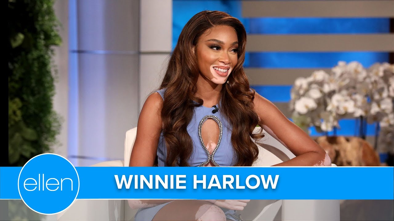 How Winnie Harlow Started Dating Her Boyfriend in Quarantine