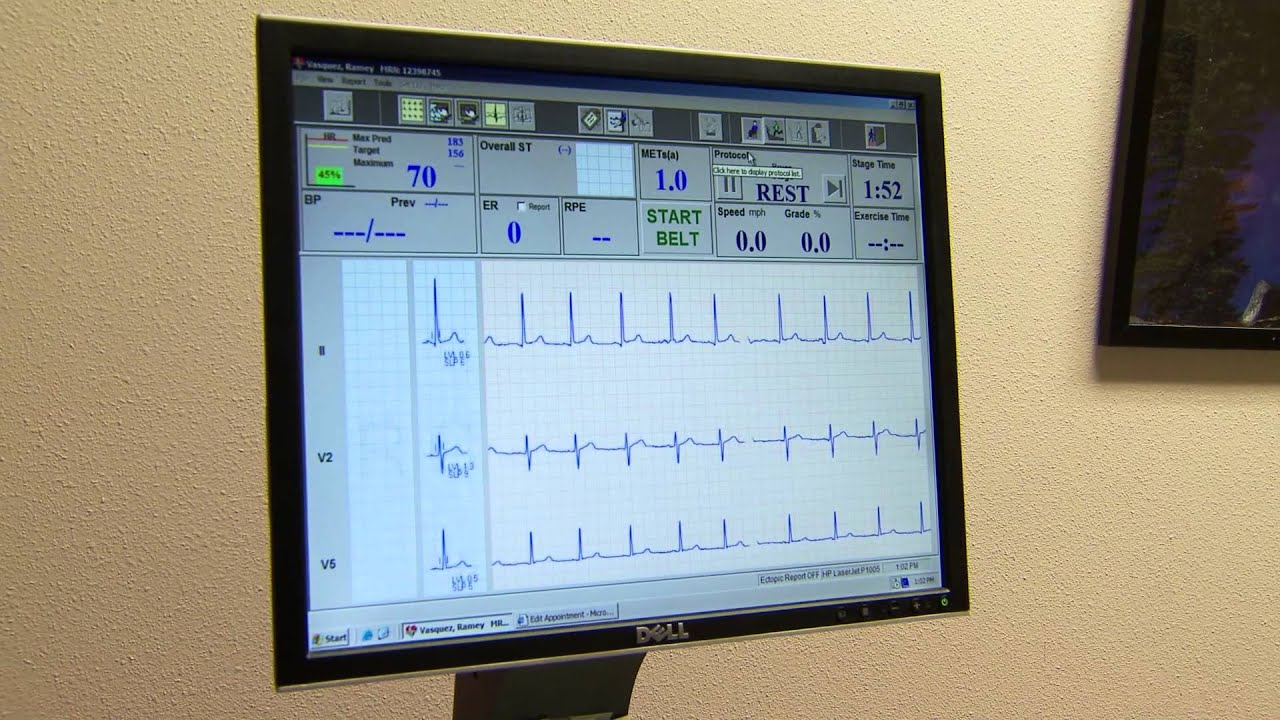 Dobutamine Stress Echo