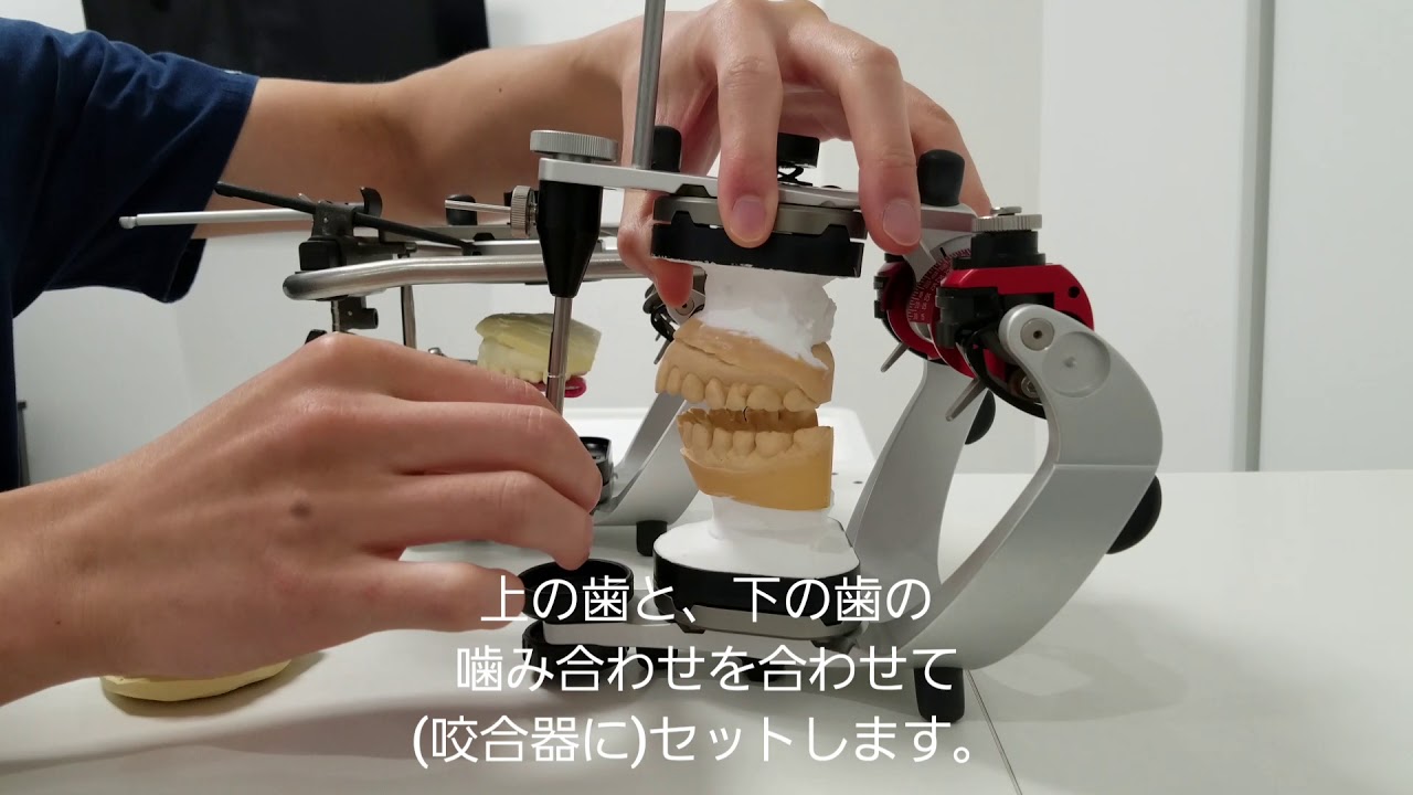 フェイスボウトランスファー、咬合器装着【デンタルアトリエ自由が丘歯科】