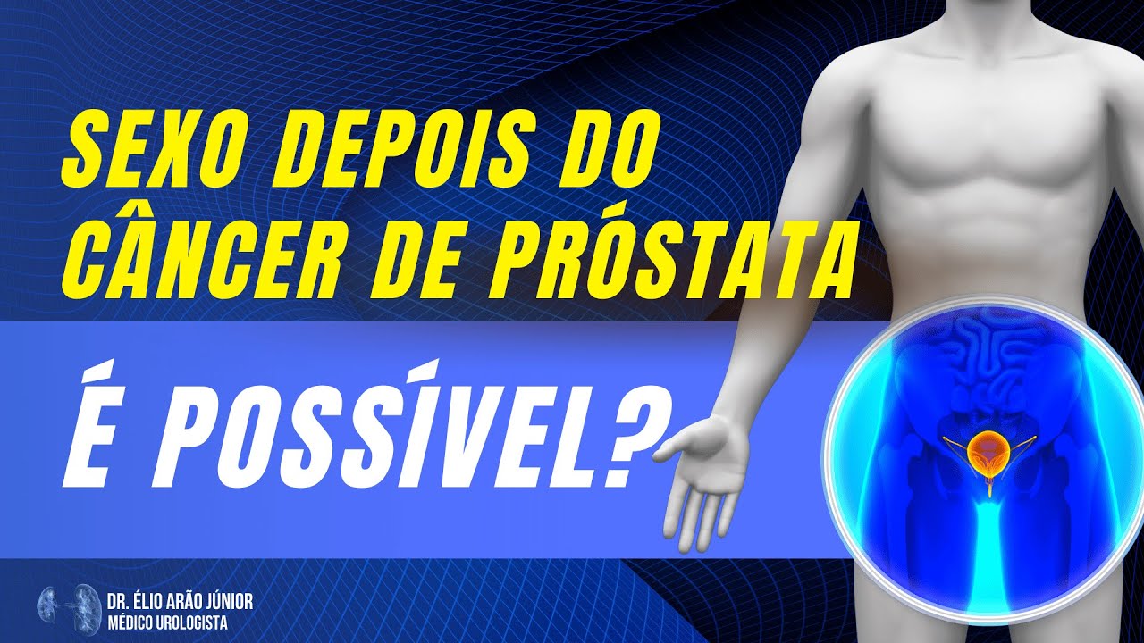 Vida sexual após câncer de próstata - É possível? | Dr. Élio Arão Junior