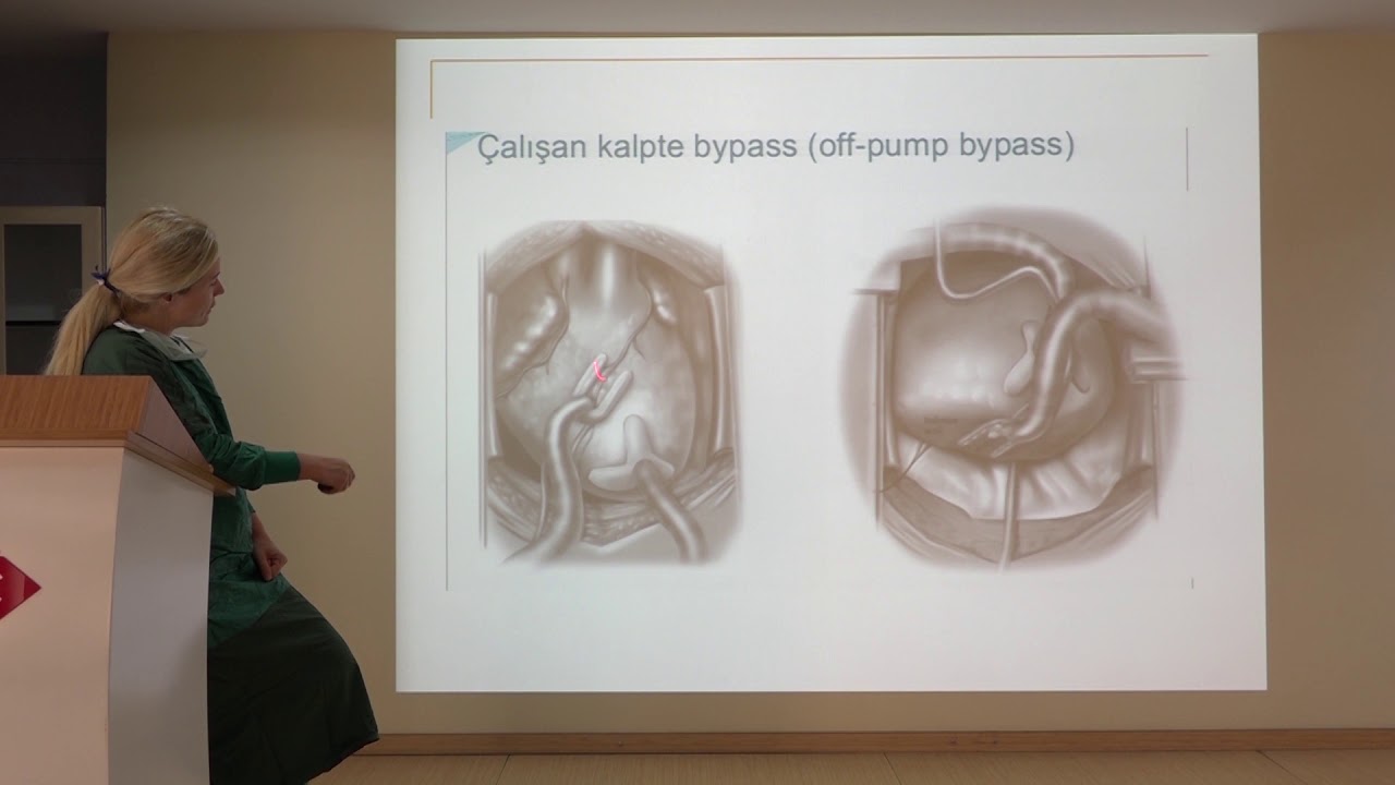 Kardiyak Cerrahide Anestezi 2. Sınıf