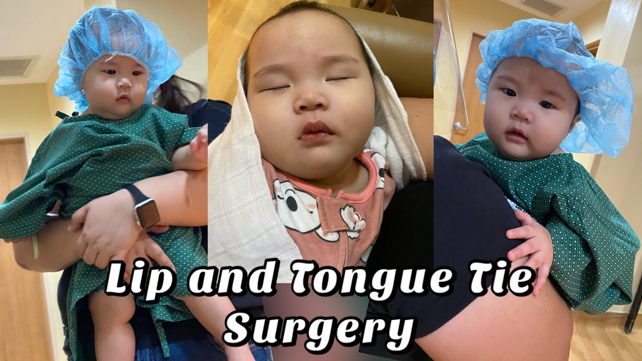 Lip and Tongue Tie Surgery and Recovery | Nica Abella (Vlog #4)
