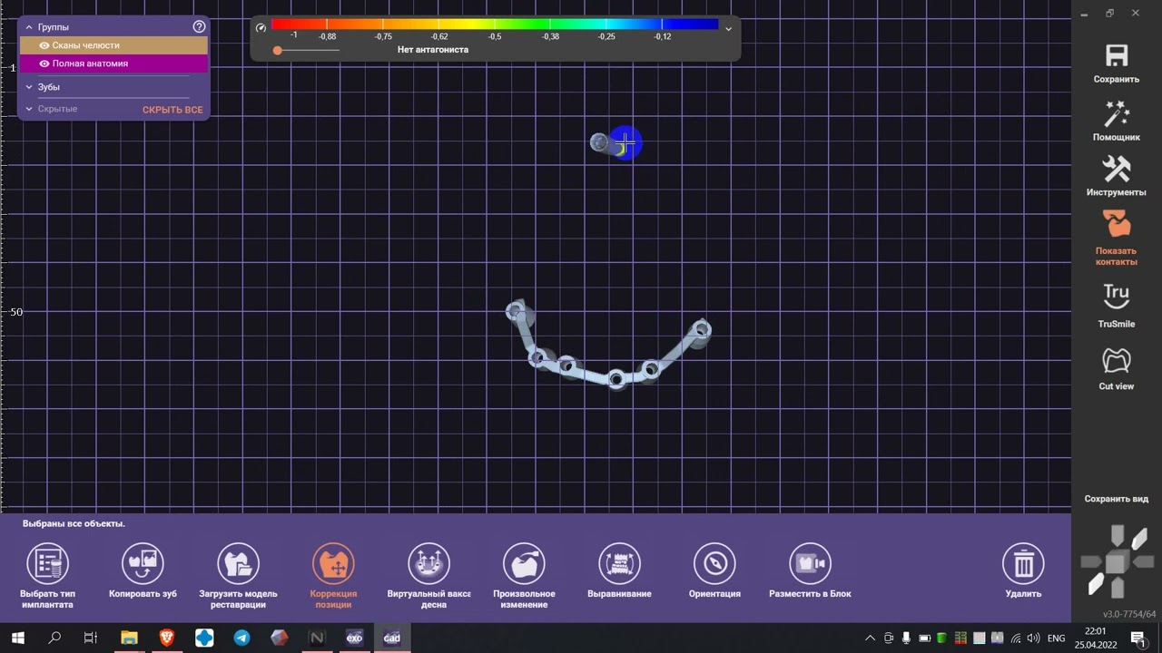 ExoCad  convert sdfa to STL