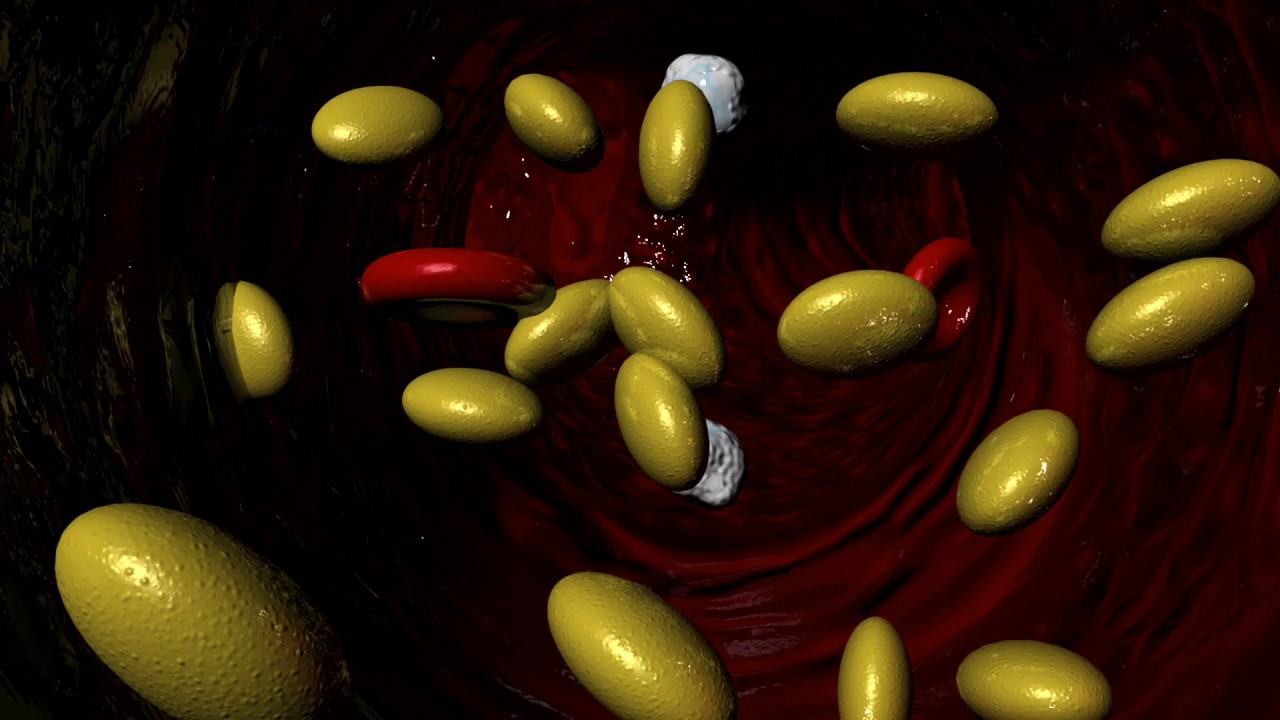 Fibrates for high Cholesterol levels