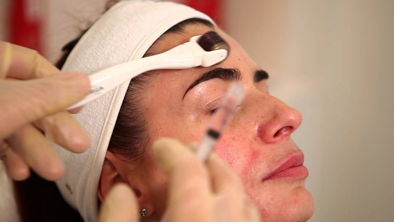 FILORGA - Bespoke NCTF 135 for Mesotherapy For Total Turnaround Results