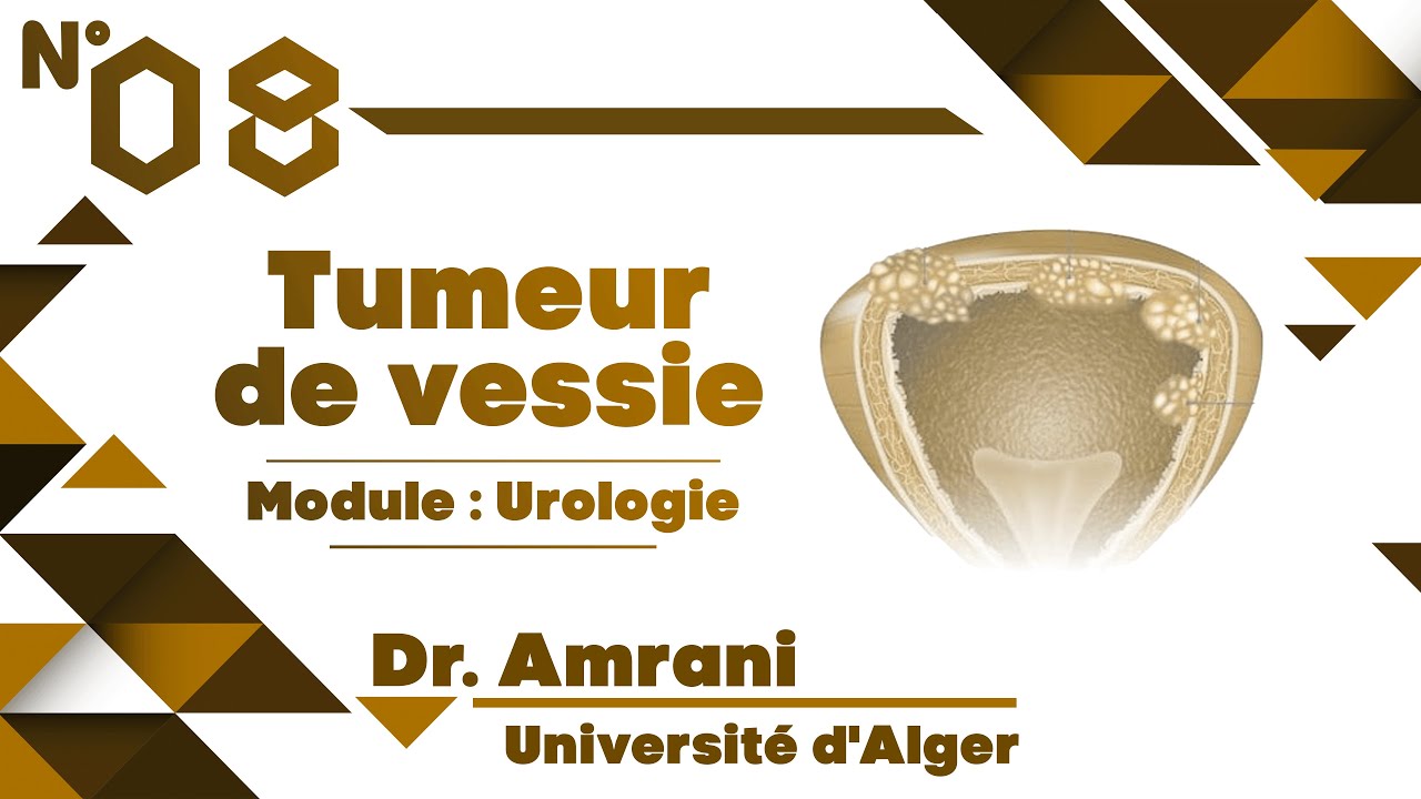 #Uro | 08. Tumeur de vessie (Dr Amrani) 2