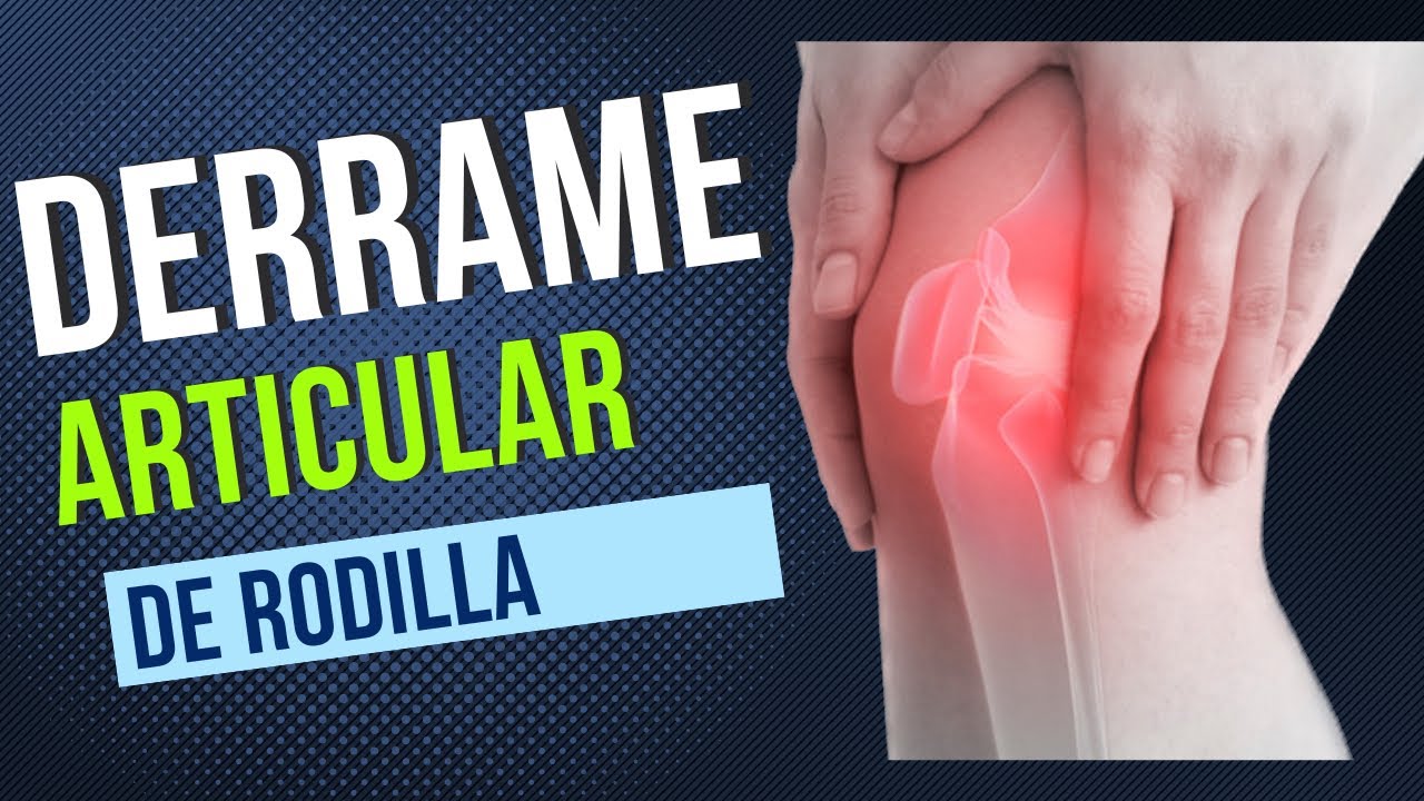 DERRAME ARTICULAR #derramearticular #artrosisderodilla #juancalbornoz