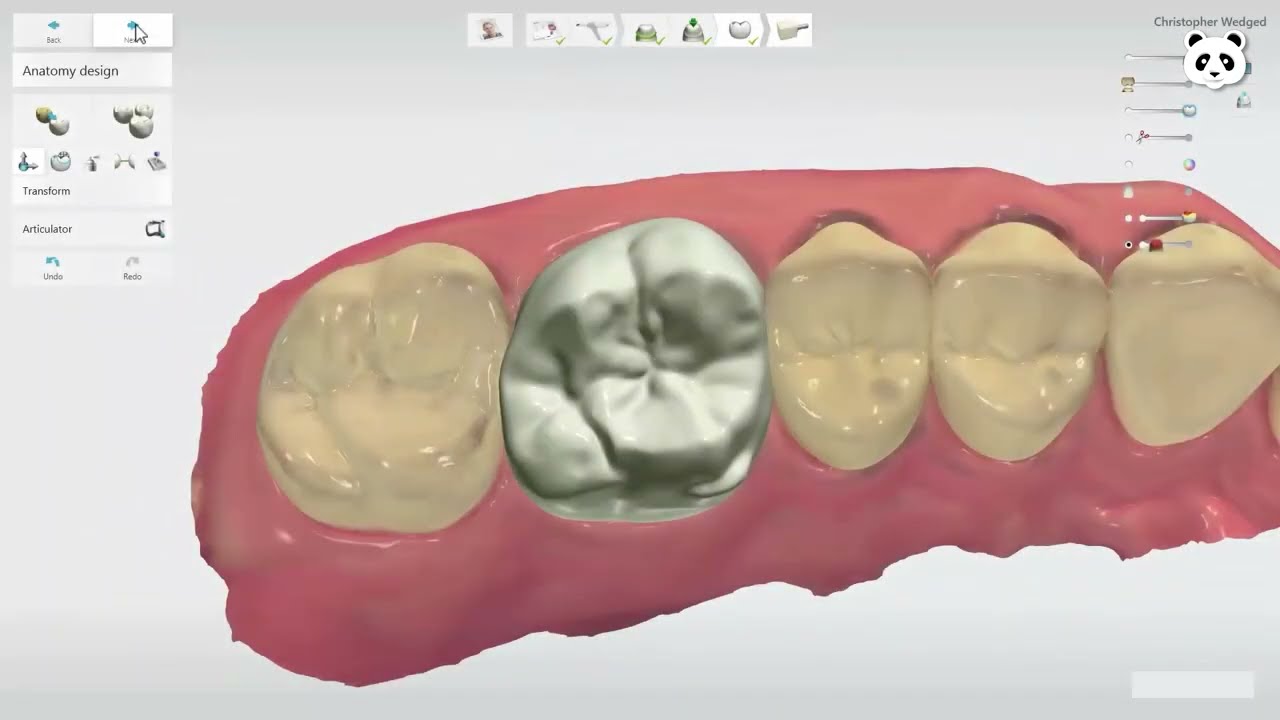 3Shape Design Studio Explained | Best Dental CAD Solution 2025