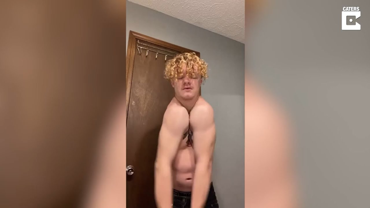 Man Born Without A Collarbone