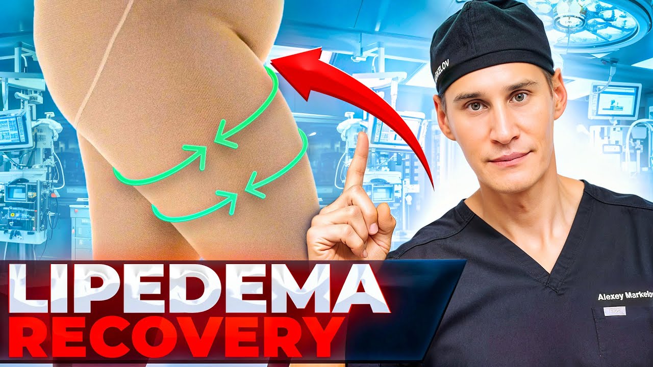 Expert Tips for LIPEDEMA Surgery Recovery