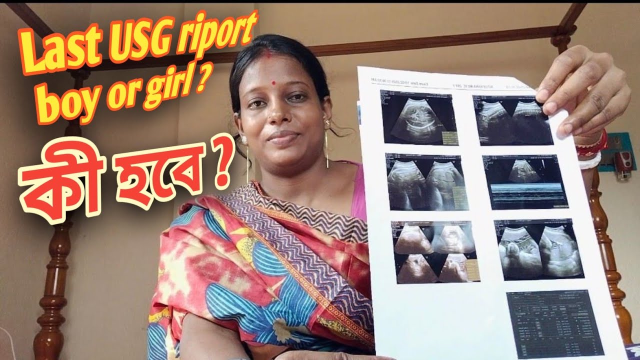 Last USG riport দেখে বুঝলাম কী হবে ? Last ultrasonography riport a boy or girl @Bidyut Ritu Vlogs