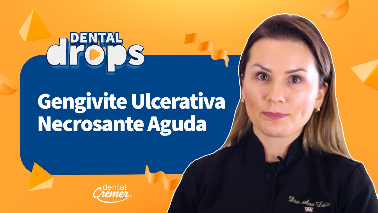 Gengivite Ulcerativa Necrosante Aguda | Dental Drops