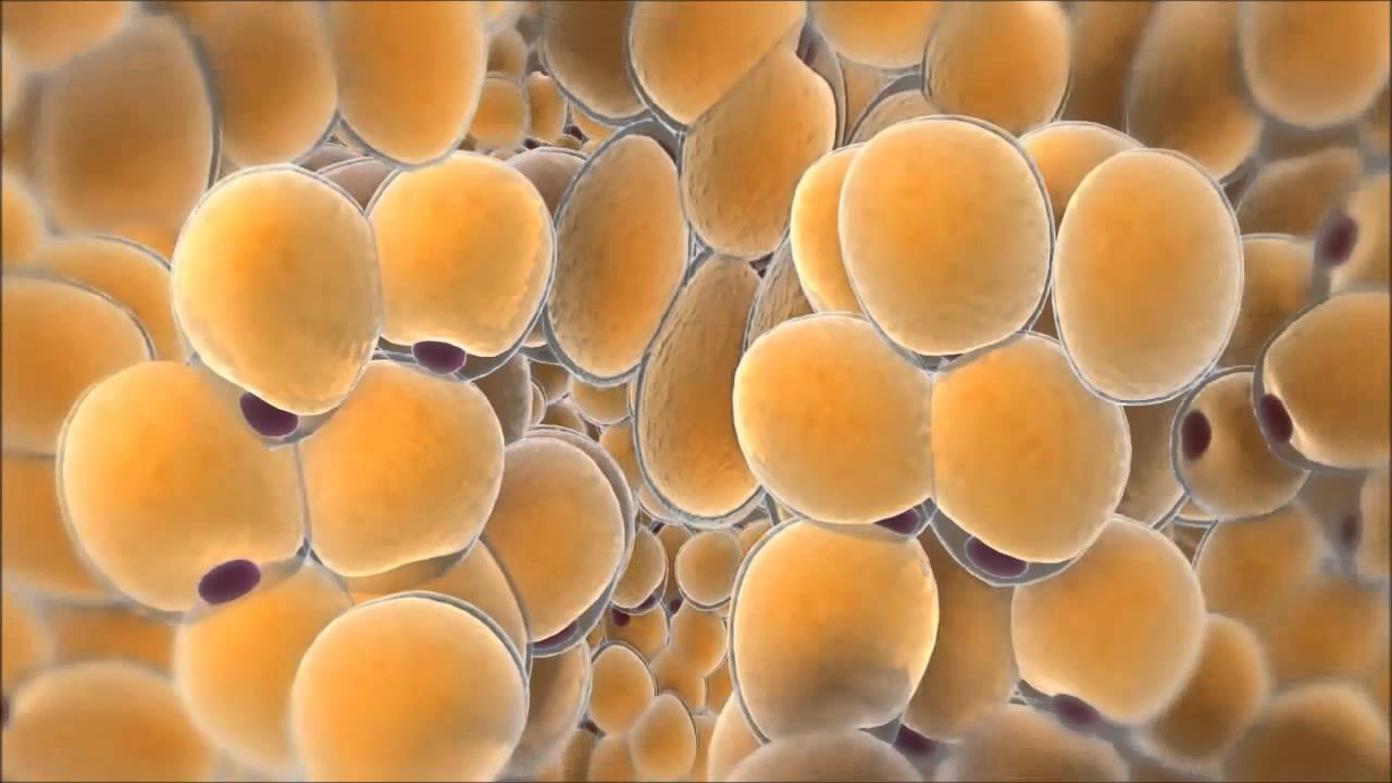 Cómo funciona la Criolipólisis