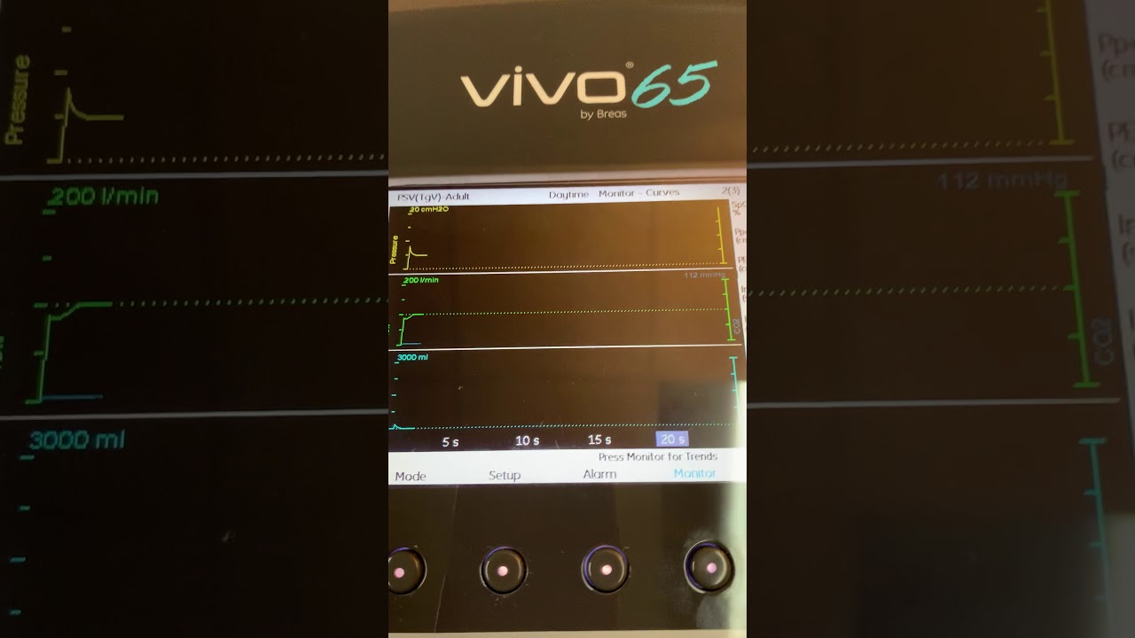 Monitoring Menu Overview - Breas Vivo 65 Ventilator