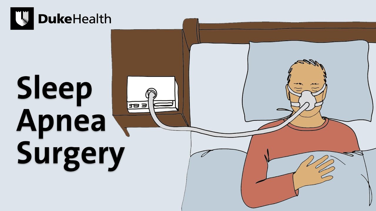 Sleep Apnea Surgery | Duke Health