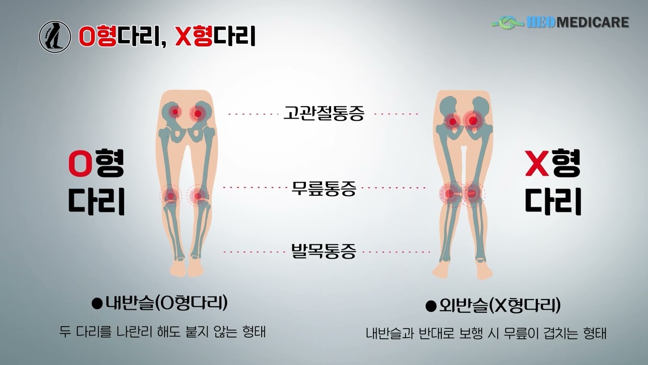 반석인솔 | 발 교정 기능성 인솔 홍보영상 (보행·족부질환 예방 헬스케어 제품)