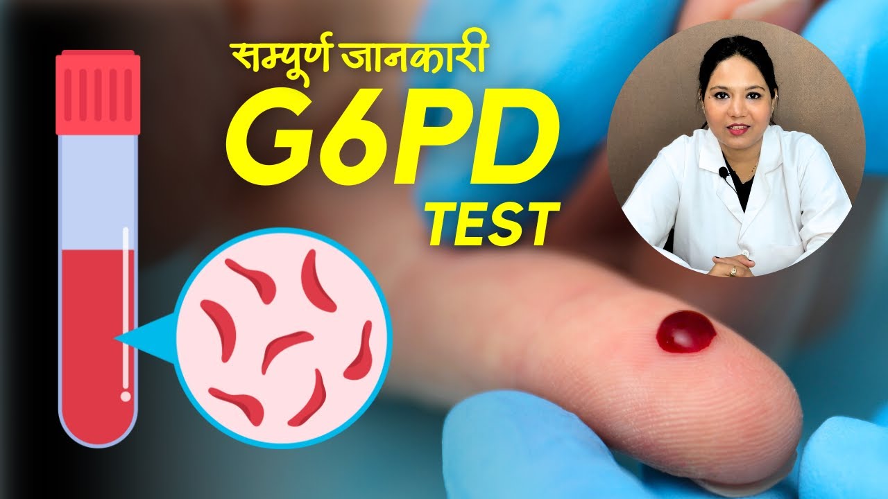 G6PD Test क्या होता है? क्यों करते हैं? कैसे करते हैं?