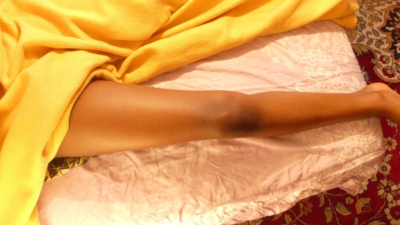 SPECIAL LEGS MASSAGE