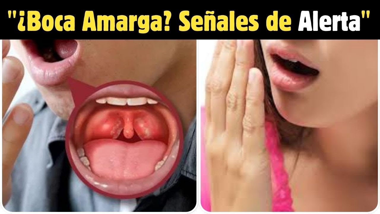 "Boca Amarga: La Razón Oculta que Deberías Saber"
