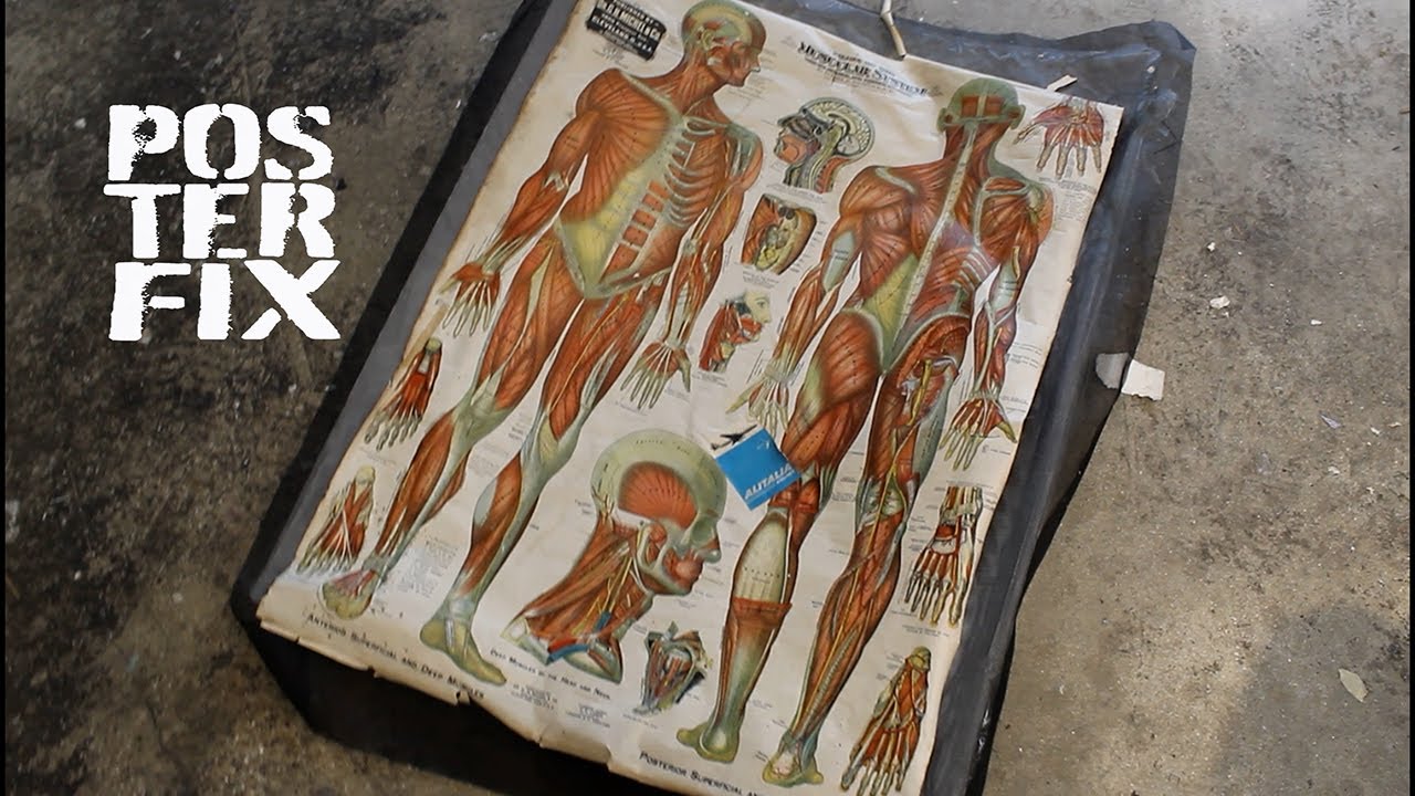 RELINING a 1910 MUSCULAR CHART Litho by G. H. Michel