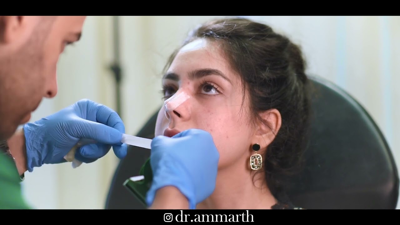 الحلقة الأخيرة Mr.Nose By Dr.A.T.H. 