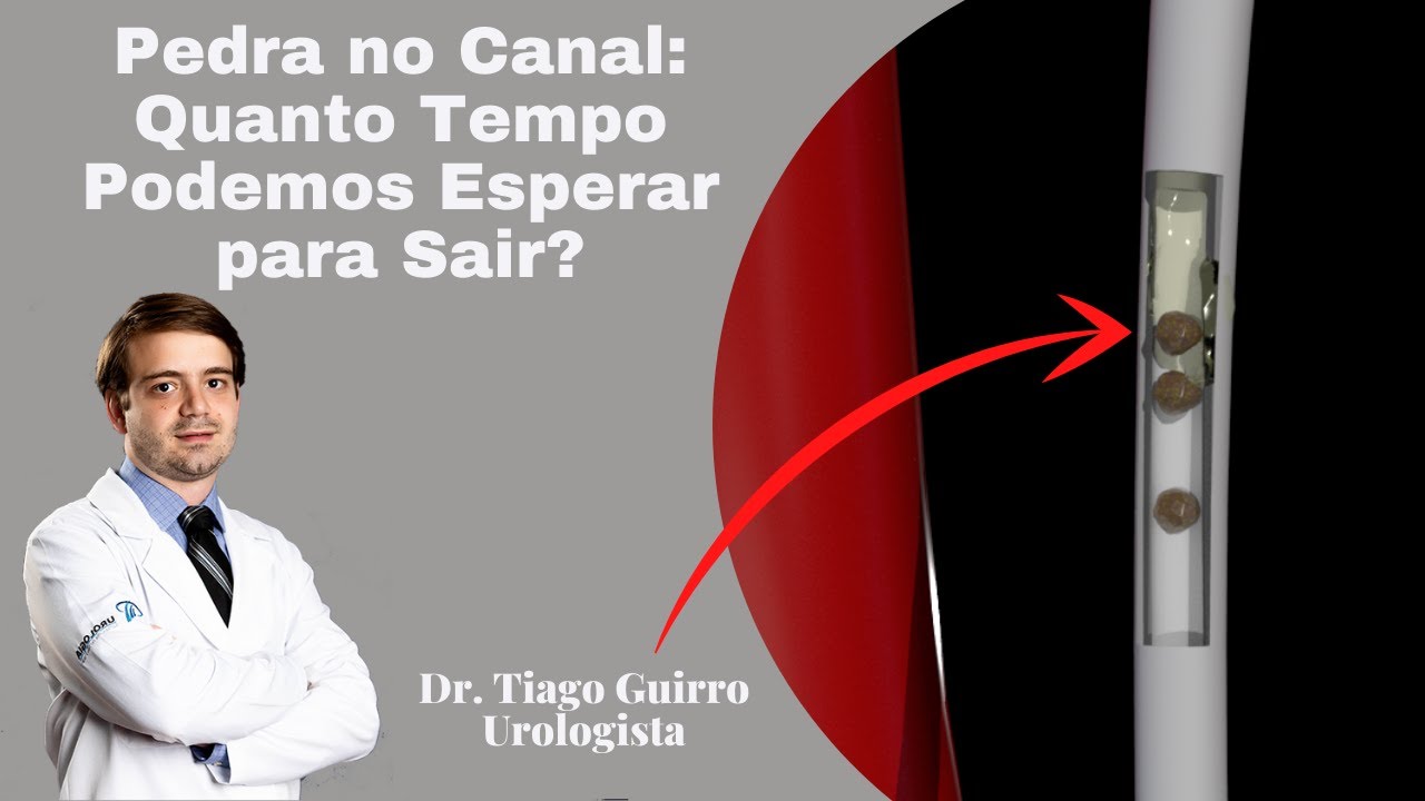 Pedra no Canal: Quanto Tempo Podemos Esperar para Sair?