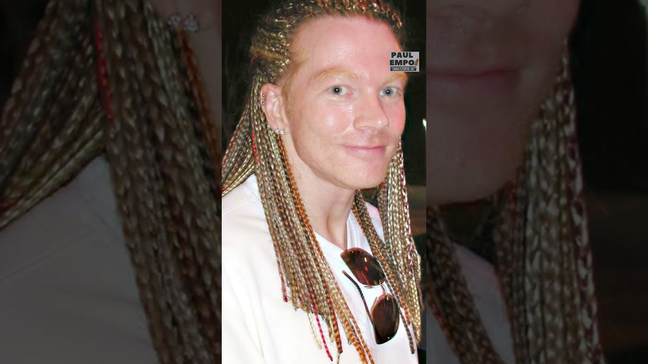 NAUNSA DIAY NIS AXL ROSE? 😞